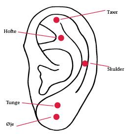 Akupunktur: Øret viser – mod gener