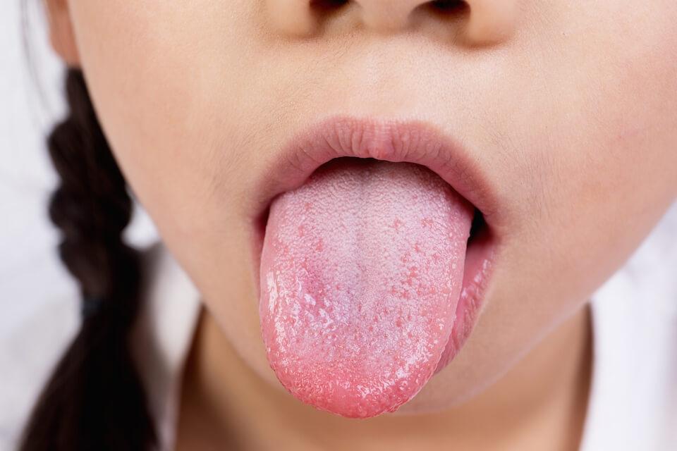 Tungen, og munden generelt, kan fortælle noget om din sundhedstilstand